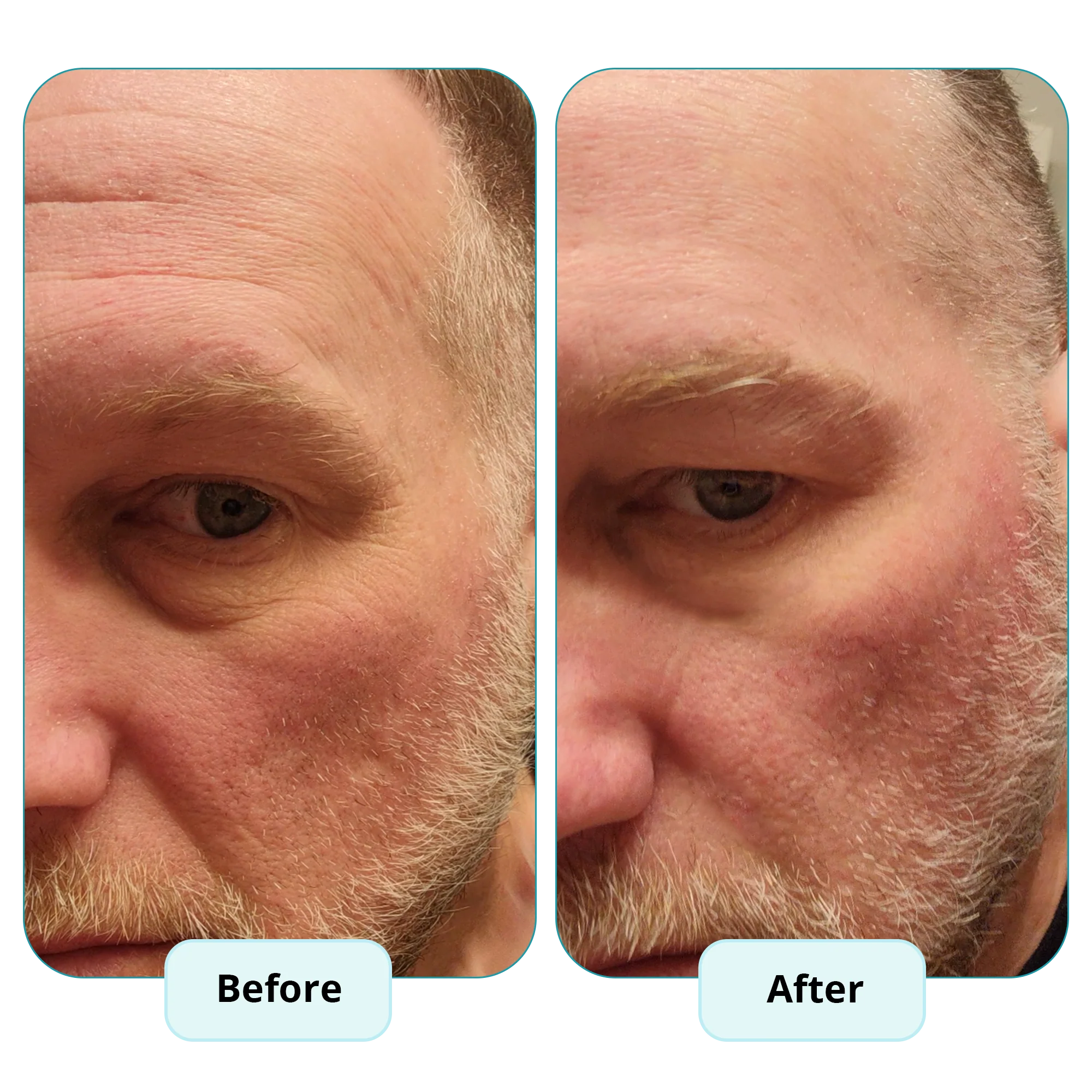 Cupids Rejuvenating Tallow Serum - Image 3